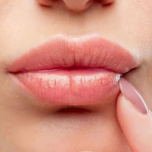 Lip Filler Treatment Trabzon