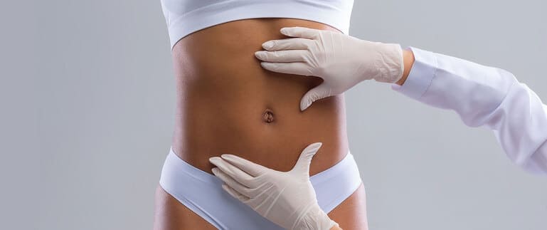 Tummy tuck surgery